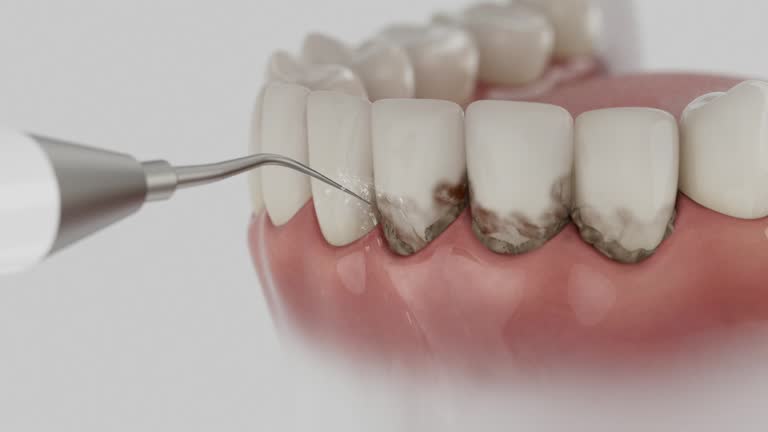 Trusted Dental Implants service in Temple Hills, MD - Dentist Open Now